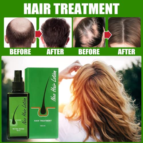 סרום צמיחת שיער לגברים ולנשים, קרם לצמיחה מחודשת של שיער 120 מ ל טיפוח צמיחת שיער, חוסם דה-די-טי לגברים ולנשים, טיפול בצמיחת